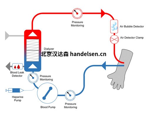 dialysis-process_air-bubble_blood-leak-detection_sonotec